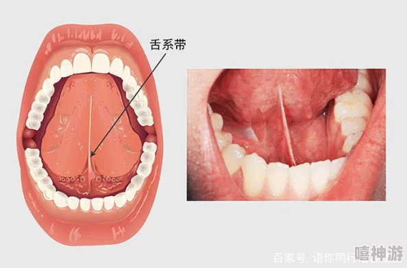 舌头探洞水好多怎么办？教你如何应对舌头不适和口腔健康问题的有效方法与建议