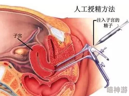 让你怀上我的种人工授精手术顺利完成静待佳音